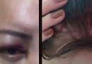 letícia ferida safadão copiar