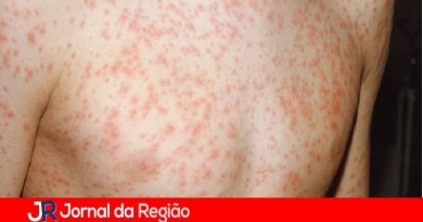 Saúde confirma três novos casos de sarampo; total chega a 26 no Estado