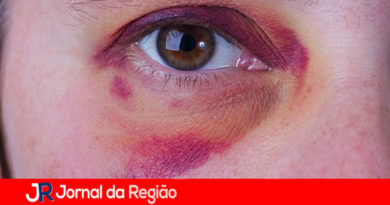 VIOLENCIA OLHO ROXO