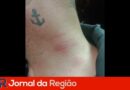 cerol