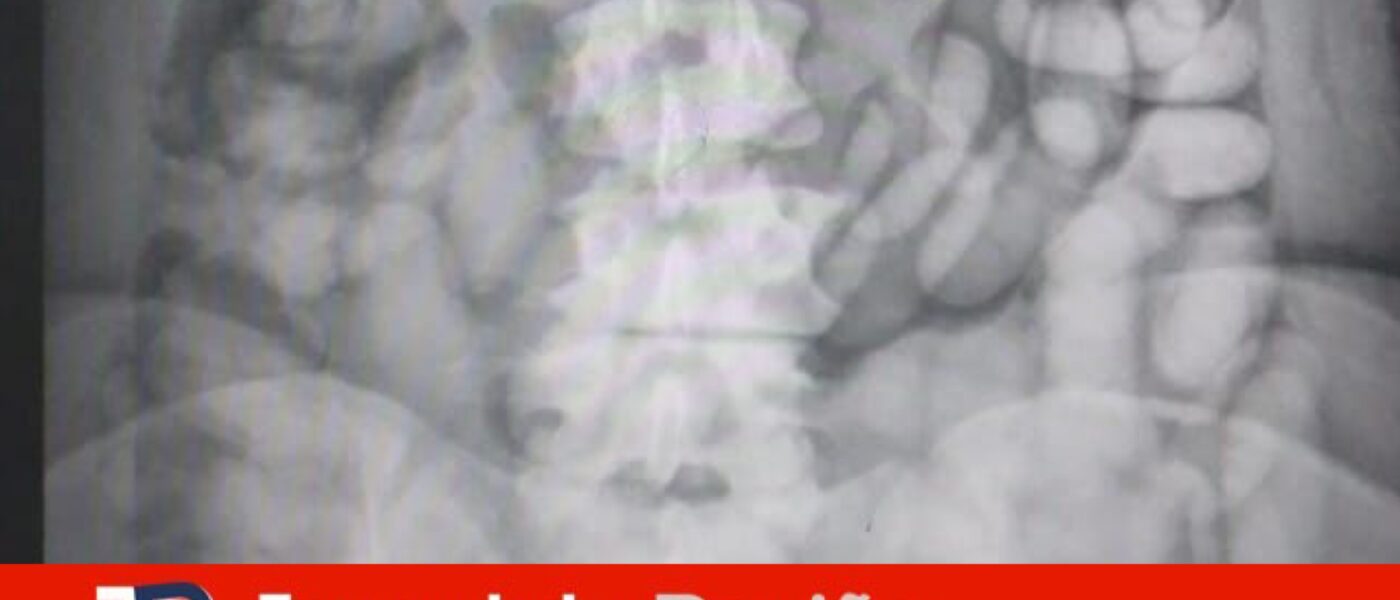 photo output 6