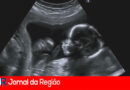 feto Depositphotos 26214099 XL copiar