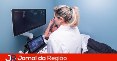 Carreta oferece exames em Jundiaí e reduz espera