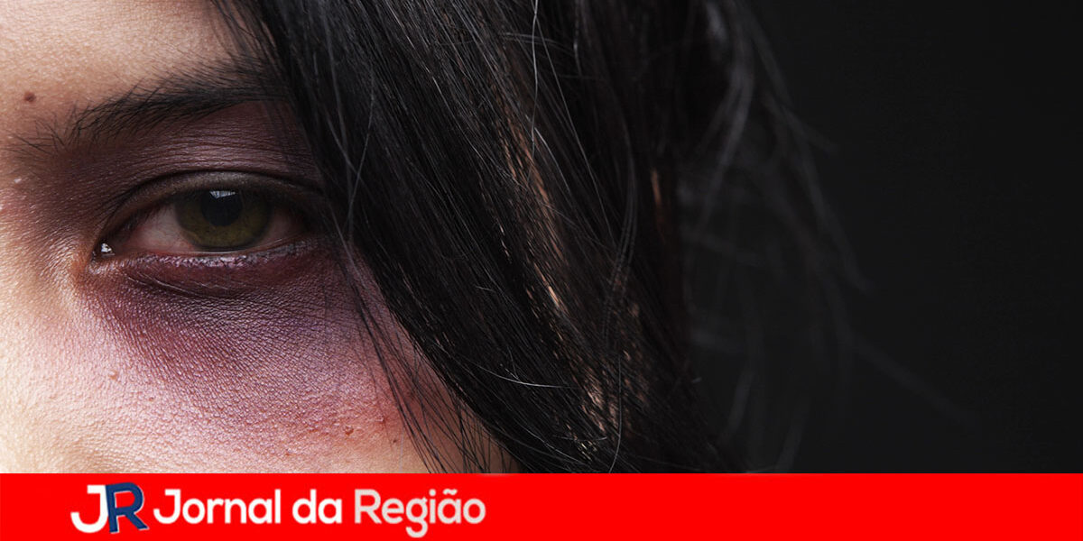 OLHO ROXO MULHER Depositphotos 11047947 XL copiar