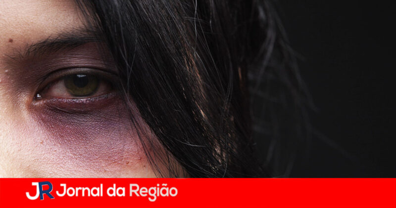 OLHO ROXO MULHER Depositphotos 11047947 XL copiar