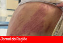 Comerciante vítima de sequestro e agressão aguarda há três dias procedimentos no Hospital São Vicente